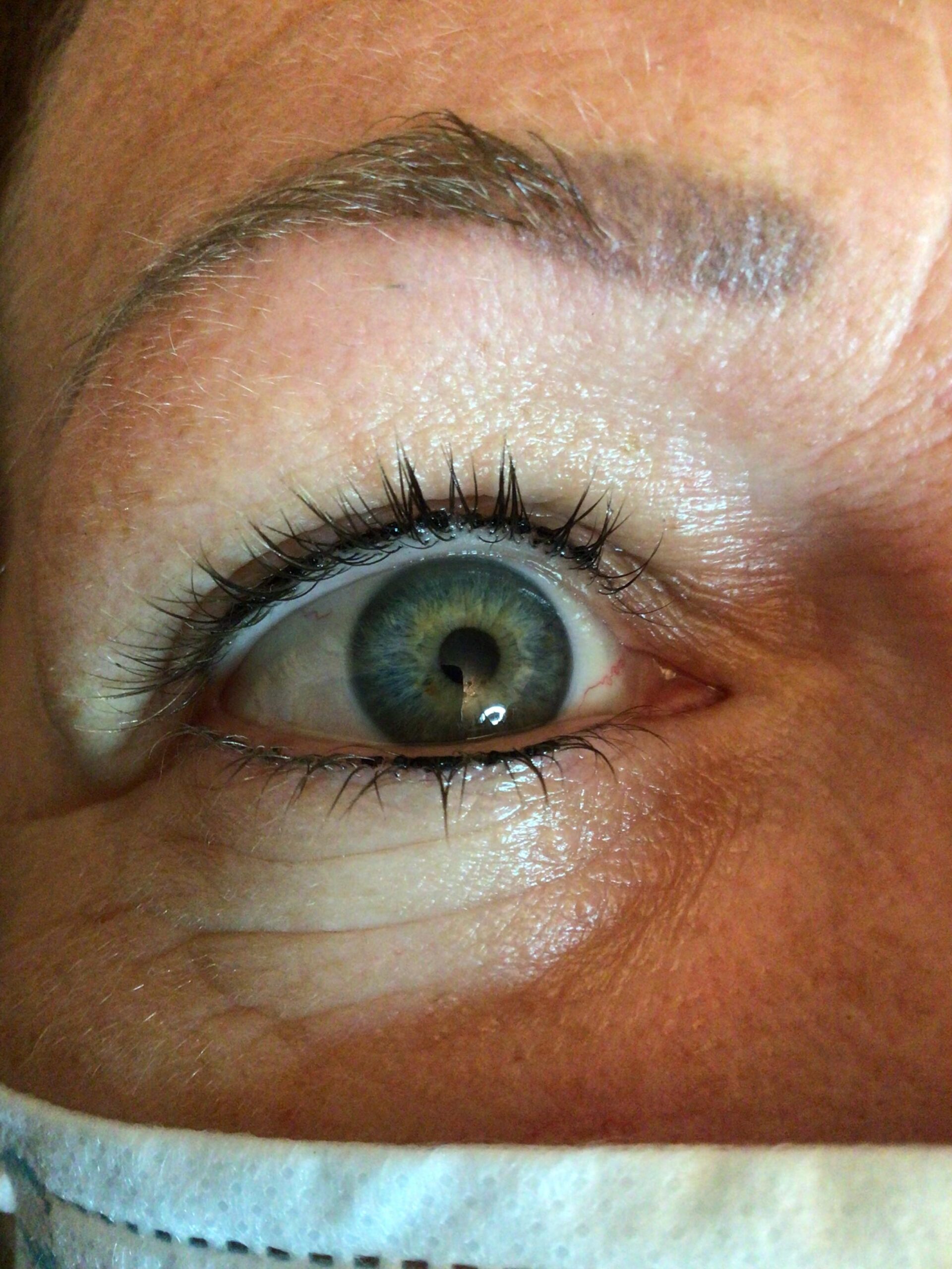 Yeux 1 après