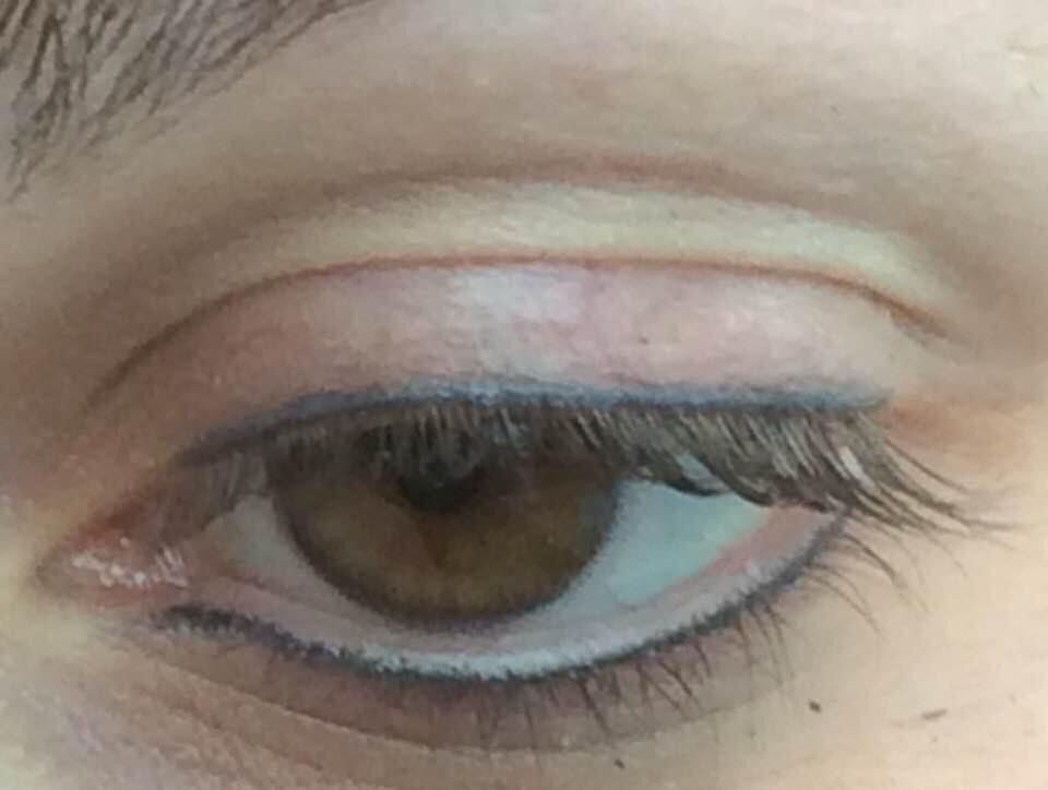 Yeux 10 après